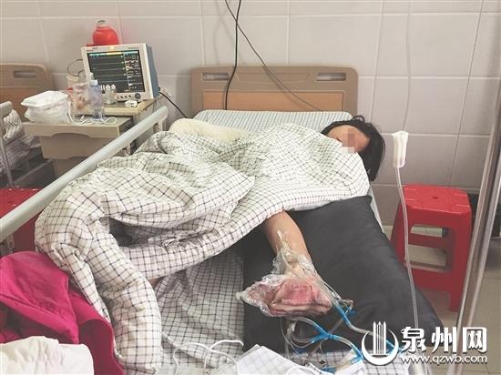 医生预计小女孩要住院2个月
